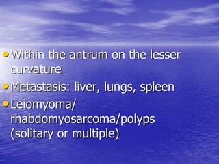 •Within the antrum on the lesser
curvature
•Metastasis: liver, lungs, spleen
•Leiomyoma/
rhabdomyosarcoma/polyps
(solitary or multiple)
 