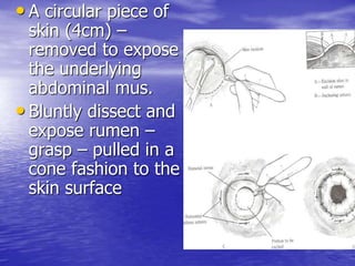 • A circular piece of
skin (4cm) –
removed to expose
the underlying
abdominal mus.
• Bluntly dissect and
expose rumen –
grasp – pulled in a
cone fashion to the
skin surface
 