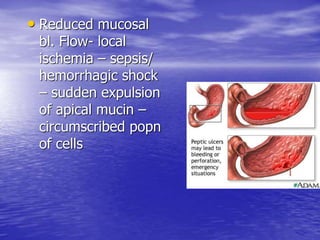 • Reduced mucosal
bl. Flow- local
ischemia – sepsis/
hemorrhagic shock
– sudden expulsion
of apical mucin –
circumscribed popn
of cells
 