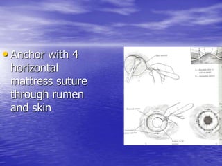 • Anchor with 4
horizontal
mattress suture
through rumen
and skin
 
