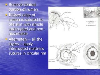• Remove central
portion of rumen
• Incised edge of
rumen is sutured to
the skin with simple
interrupted and non-
absorbable
• Alternately – all the
layers – apply
interrupted mattress
sutures in circular rim
 