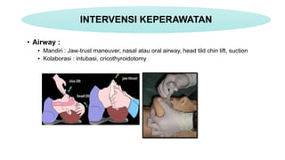 • Airway :
• Mandiri : Jaw-trust maneuver, nasal atau oral airway, head tild chin lift, suction
• Kolaborasi : intubasi, cricothyroidotomy
INTERVENSI KEPERAWATAN
 