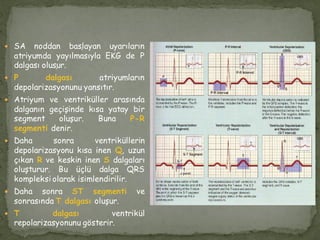  SA noddan başlayan uyarıların
atriyumda yayılmasıyla EKG de P
dalgası oluşur.
 P dalgası atriyumların
depolarizasyonunu yansıtır.
 Atriyum ve ventriküller arasında
dalganın geçişinde kısa yatay bir
segment oluşur. Buna P-R
segmenti denir.
 Daha sonra ventriküllerin
depolarizasyonu kısa inen Q, uzun
çıkan R ve keskin inen S dalgaları
oluşturur. Bu üçlü dalga QRS
kompleksi olarak isimlendirilir.
 Daha sonra ST segmenti ve
sonrasında T dalgası oluşur.
 T dalgası ventrikül
repolarizasyonunu gösterir.
 