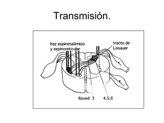 Transmisión.
 