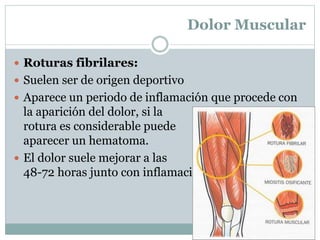 Dolor Muscular
 Roturas fibrilares:
 Suelen ser de origen deportivo
 Aparece un periodo de inflamación que procede con
la aparición del dolor, si la
rotura es considerable puede incluso
aparecer un hematoma.
 El dolor suele mejorar a las
48-72 horas junto con inflamación.
 