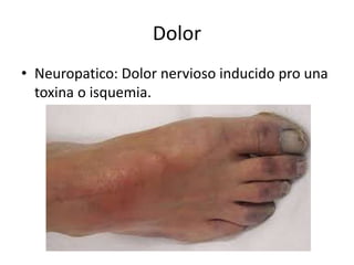 Dolor
• Neuropatico: Dolor nervioso inducido pro una
toxina o isquemia.
 
