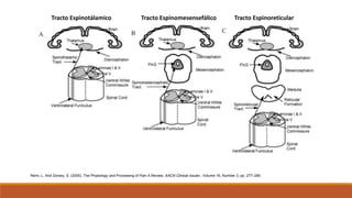 Tracto Espinotálamico Tracto Espinomesensefálico Tracto Espinoreticular
Renn, L. And Dorsey, S. (2005). The Physiology and Processing of Pain A Review. AACN Clinical Issues , Volume 16, Number 3, pp. 277–290
 