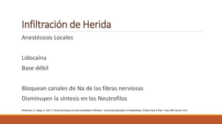 Infiltración de Herida
Anestésicos Locales
Lidocaína
Base débil
Bloquean canales de Na de las fibras nerviosas
Disminuyen la síntesis en los Neutrofilos
Whiteman, A.; Bajaj, S. (2011). Novel techniques of local anaesthetic infiltration. Continuing Education in Anaesthesia, Critical Care & Pain: Topic 398 Version 35.0
 