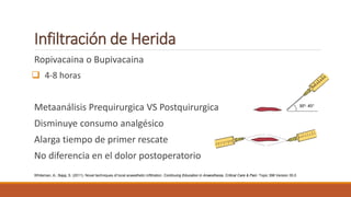 Infiltración de Herida
Ropivacaina o Bupivacaina
 4-8 horas
Metaanálisis Prequirurgica VS Postquirurgica
Disminuye consumo analgésico
Alarga tiempo de primer rescate
No diferencia en el dolor postoperatorio
Whiteman, A.; Bajaj, S. (2011). Novel techniques of local anaesthetic infiltration. Continuing Education in Anaesthesia, Critical Care & Pain: Topic 398 Version 35.0
 