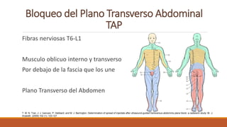 Bloqueo del Plano Transverso Abdominal
TAP
Fibras nerviosas T6-L1
Musculo oblicuo interno y transverso
Por debajo de la fascia que los une
Plano Transverso del Abdomen
T. M. N. Tran, J. J. Ivanusic, P. Hebbard, and M. J. Barrington. Determination of spread of injectate after ultrasound-guided transversus abdominis plane block: a cadaveric study: Br. J.
Anaesth. (2009) 102 (1): 123-127
 