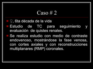 Caso # 2 ♀ , 6ta década de la vida  Estudio de TC para seguimiento y evaluación  de quistes renales.  Se realiza estudio con medio de contraste endovenoso, mostrándose la fase venosa, con cortes axiales y con reconstrucciones multiplanares (RMP) coronales.  