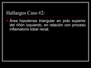 Hallazgos Caso #2: Área hipodensa triangular en polo superior del riñón izquierdo, en relación con proceso inflamatorio lobar renal. 
