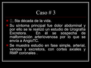 Caso # 3 ♀ , 5ta década de la vida.  Su síntoma principal fue dolor abdominal y por ello se le realizó un estudio de Urografía Excretora.  En él se sospecha de malformación arteriovenosa por lo que se envía a AngioTC. Se muestra estudio en fase simple, arterial, venosa y excretora, con cortes axiales y RMP coronales . 