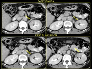 FASE VENOSA FASE ELIMINACION 