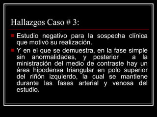 Hallazgos Caso # 3: Estudio negativo para la sospecha clínica que motivó su realización. Y en el que se demuestra, en la fase simple sin anormalidades, y posterior  a la ministración del medio de contraste hay un área hipodensa triangular en polo superior del riñón izquierdo, la cual se mantiene durante las fases arterial y venosa del estudio. 