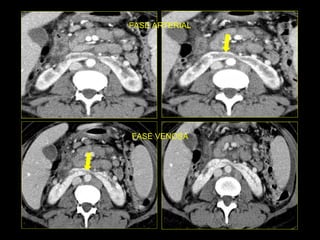 FASE ARTERIAL FASE VENOSA 