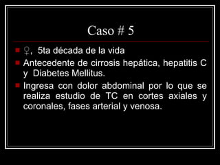 Caso # 5 ♀ ,  5ta década de la vida Antecedente de cirrosis hepática, hepatitis C y  Diabetes Mellitus. Ingresa con dolor abdominal por lo que se realiza estudio de TC en cortes axiales y coronales, fases arterial y venosa.  