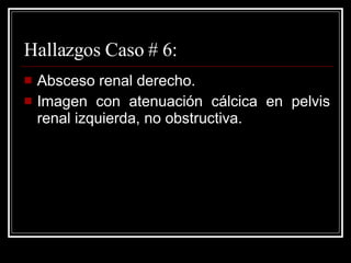 Hallazgos Caso # 6: Absceso renal derecho.  Imagen con atenuación cálcica en pelvis renal izquierda, no obstructiva. 