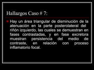 Hallazgos Caso # 7: Hay un área triangular de disminución de la atenuación en la parte posterolateral del  riñón izquierdo, las cuales se demuestran en fases contrastadas, y en fase excretora muestran persistencia del medio de contraste, en relación con proceso inflamatorio focal.  