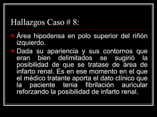 Hallazgos Caso # 8: Área hipodensa en polo superior del riñón izquierdo.  Dada su apariencia y sus contornos que eran bien delimitados se sugirió la posibilidad de que se tratase de área de infarto renal. Es en ese momento en el que el médico tratante aporta el dato clínico que la paciente tenia fibrilación auricular reforzando la posibilidad de infarto renal. 