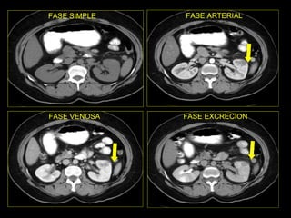 FASE SIMPLE FASE ARTERIAL FASE VENOSA FASE EXCRECION 