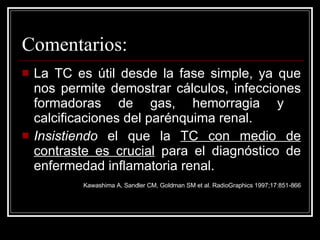 Comentarios: La TC es útil desde la fase simple, ya que nos permite demostrar cálculos, infecciones formadoras de gas, hemorragia y  calcificaciones del parénquima renal. Insistiendo  el que la  TC con medio de contraste es crucial  para el diagnóstico de enfermedad inflamatoria renal.   Kawashima A, Sandler CM, Goldman SM et al. RadioGraphics 1997;17:851-866 