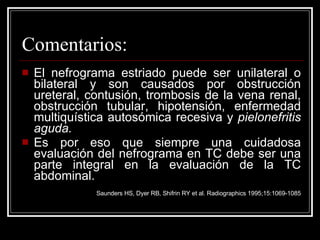 Comentarios: El nefrograma estriado puede ser unilateral o bilateral y son causados por obstrucción ureteral, contusión, trombosis de la vena renal, obstrucción tubular, hipotensión, enfermedad multiquística autosómica recesiva y  pielonefritis aguda. Es por eso que siempre una cuidadosa evaluación del nefrograma en TC debe ser una parte integral en la evaluación de la TC abdominal.  Saunders HS, Dyer RB, Shifrin RY et al. Radiographics 1995;15:1069-1085 