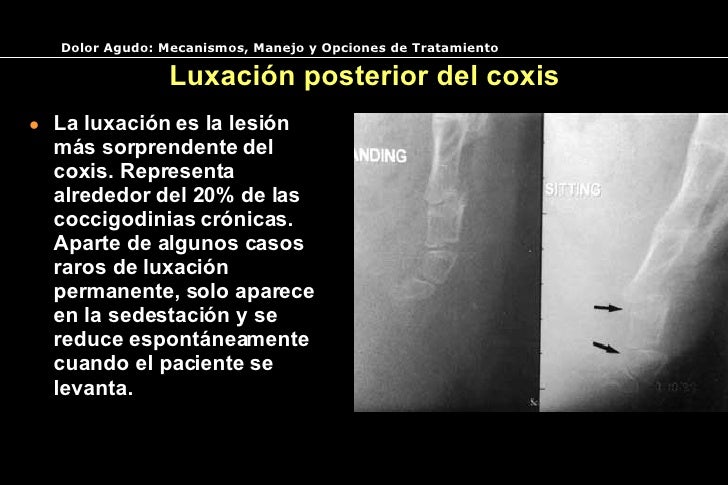 El dolor punzante en el cuello de la parte izquierda