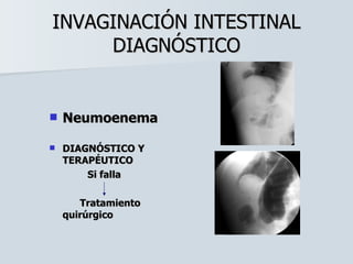 INVAGINACIÓN INTESTINAL DIAGNÓSTICO Neumoenema DIAGNÓSTICO Y TERAPÉUTICO   Si falla   Tratamiento  quirúrgico 