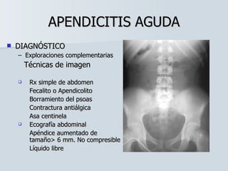 APENDICITIS AGUDA DIAGNÓSTICO Exploraciones complementarias Técnicas de imagen Rx simple de abdomen Fecalito o Apendicolito Borramiento del psoas Contractura antiálgica Asa centinela Ecografía abdominal Apéndice aumentado de  tamaño> 6 mm. No compresible Líquido libre 
