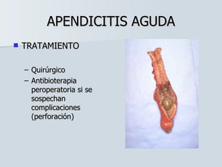 APENDICITIS AGUDA TRATAMIENTO Quirúrgico Antibioterapia peroperatoria si se sospechan complicaciones (perforación) 