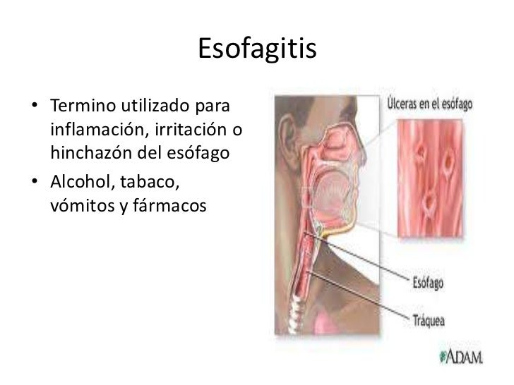 Los ejercicios regulares para el adelgazamiento de todo el cuerpo