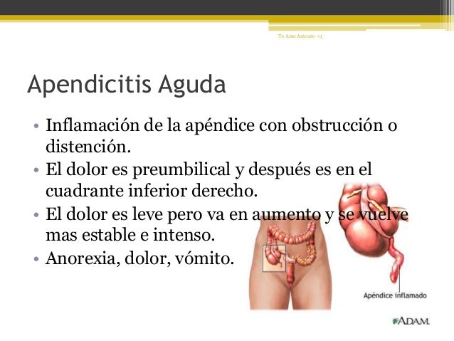 Dolor abdominal