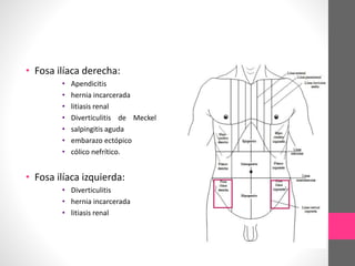 • Fosa ilíaca derecha:
• Apendicitis
• hernia incarcerada
• litiasis renal
• Diverticulitis de Meckel
• salpingitis aguda
• embarazo ectópico
• cólico nefrítico.
• Fosa ilíaca izquierda:
• Diverticulitis
• hernia incarcerada
• litiasis renal
 