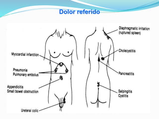 Dolor referido
 
