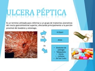 ULCERA PÉPTICA
Es un termino utilizado para referirse a un grupo de trastornos ulcerativos
del tracto gastrointestinal superior, afectando principalmente a la porción
proximal del duodeno y estomago.
H.Pylori
Aines
• Síndrome de
zollinger
• Tabaquismo
• Estrés
• Linfoma
• Enf de Crohn
95%
5%
 