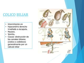 • Intermitente en
• hipocondrio derecho
irradiado a escapula.
• Nausea.
• Vomito.
• Causa: obstrucción de
los canales biliares
(cístico o colédoco)
generalmente por un
calculo biliar
COLICO BILIAR
 