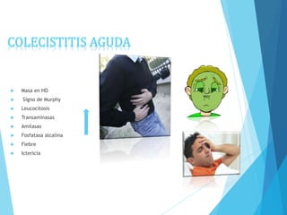  Masa en HD
 Signo de Murphy
 Leucocitosis
 Transaminasas
 Amilasas
 Fosfatasa alcalina
 Fiebre
 Ictericia
COLECISTITIS AGUDA
 