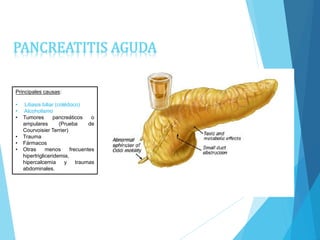 PANCREATITIS AGUDA
Principales causas:
• Litiasis biliar (colédoco)
• Alcoholismo
• Tumores pancreáticos o
ampulares (Prueba de
Courvoisier Terrier)
• Trauma
• Fármacos
• Otras menos frecuentes
hipertrigliceridemia,
hipercalcemia y traumas
abdominales.
 