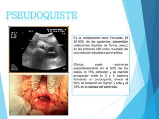 Es la complicación mas frecuente. El
30-50% de los pacientes desarrollan
colecciones liquidas de forma precoz
en las primeras 48h como resultado de
una reacción exudativa pancreática.
Clínica: suele resolverse
espontáneamente en el 50% de los
casos, el 15% persisten y se pueden
encapsular entre la 3 y 6 semana
formando un psudoquiste; donde el
85% se localizan en cuerpo y cola y el
15% en la cabeza del páncreas.
PSEUDOQUISTE
 
