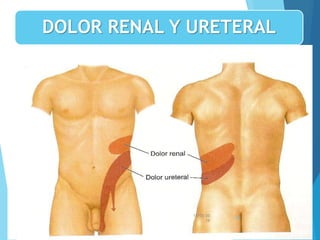 DOLOR RENAL Y URETERAL
13/05/20
16
55
 