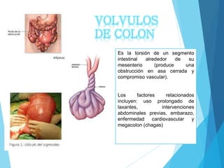 Es la torsión de un segmento
intestinal alrededor de su
mesenterio (produce una
obstrucción en asa cerrada y
compromiso vascular).
Los factores relacionados
incluyen: uso prolongado de
laxantes, intervenciones
abdominales previas, embarazo,
enfermedad cardiovascular y
megacolon (chagas)
VOLVULOS
DE COLON
 
