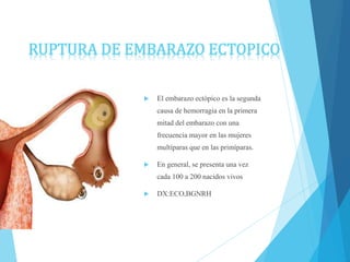  El embarazo ectópico es la segunda
causa de hemorragia en la primera
mitad del embarazo con una
frecuencia mayor en las mujeres
multíparas que en las primíparas.
 En general, se presenta una vez
cada 100 a 200 nacidos vivos
 DX:ECO,BGNRH
RUPTURA DE EMBARAZO ECTOPICO
 