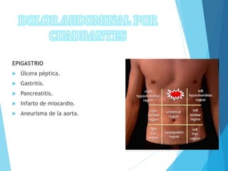 EPIGASTRIO
 Úlcera péptica.
 Gastritis.
 Pancreatitis.
 Infarto de miocardio.
 Aneurisma de la aorta.
 