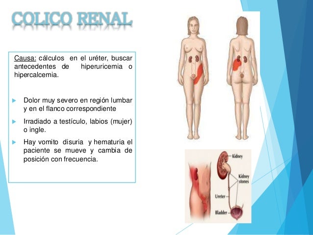 dolor de pierna izquierda hasta la ingle