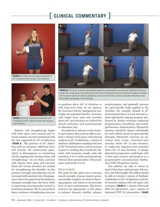 [       CLINICAL COMMENTARY                                                 ]
                                                           A




           Shoulder external rotation performed at
 30° of abduction with red sport cord resistance.




                                                                       This series of pictures demonstrates plyometric proprioceptive neuromuscular facilitation D2 reverse
                                                           throws with a small, green, 1-kg medicine ball. (A) To start, the therapist throws the ball over the patient’s shoulder.
                                                           (B) The patient catches the ball and decelerates it down to the front foot, (C) then accelerates the ball back over
                                                           the shoulder, (D) throwing it to the therapist.

                                                          in positions above 90° of elevation or                         proprioception, and gradually increase
                                                          with long lever arms. In our opinion,                          the sport-speciﬁc loads applied to the
                                                          the increased risk for impingement out-                        shoulder. For example, Swanik et al71
                                                          weighs the potential beneﬁts. Exercises                        demonstrated that a 6-week internal ro-
            Rhythmic stabilization performed at 90°       with longer lever arms and exercises                           tation plyometric training program per-
 of abduction and 90° external rotation with red sport    above 90° arm elevation are utilized for                       formed by female swimmers enhanced
 cord resistance.                                         muscle endurance and neuromuscular                             proprioception, kinesthesia, and muscle
                                                          re-education only.                                             performance characteristics. Plyometric
   Rotator cuff strengthening begins                         For patients to advance to the return-                      exercises should be chosen individually
with basic sport cord external and in-                    to-sport phase, they must be able to per-                      for each athlete based on sport-speciﬁc
ternal rotation exercises performed with                  form 1 minute of red sport cord external                       demands. Plyometric exercises are ad-
the arm supported at 30° of abduction                     rotation at 30° of abduction, 1 minute of                      vanced from 2-arm, short-lever-arm
(         ). The position of 30° abduc-                   rhythmic stabilization standing with arm                       activities below 90° of arm elevation,
tion with an isometric adduction force                    at 90° forward elevation, and no increase                      to single-arm long-lever-arm activities
will increase the subacromial space,                      in pain or swelling after treatments. Pa-                      above 90° of arm elevation. A sample
which is advantageous in minimizing                       tients with tenotomy usually make the                          plyometric progression could begin with
risk for impingement during rotator cuff                  transition 4 to 6 weeks postoperatively,                       a chest pass exercise and progress to a
strengthening.32 At our clinic, exercises                 whereas those posttenodesis will not ad-                       proprioceptive neuromuscular facilita-
with shorter lever arms and exercises                     vance until weeks 8 to 12.                                     tion (PNF) D2 pattern exercise.
below 90° of arm elevation are utilized                                                                                     Our athletes are able to return to
for strengthening the shoulder. In this                                                                                  sport if they have minimal pain, full mo-
position, strength and endurance can be                   The goals for this phase are to increase                       tion, and full strength. The athlete should
increased with minimal risk of impinge-                   muscle strength, increase muscle power,                        be able to tolerate 1 minute of rhythmic
ment. Once the patient has developed an                   successfully complete an interval throw-                       stabilization at 90° of abduction and 90°
adequate strength base, the focus shifts                  ing program, and return to the previous                        of external rotation with red sport cord
to improving neuromuscular control in                     level of sport participation. Plyometric                       resistance (         ), 1 minute of forward
functional positions. We do not perform                   exercises are appropriate at this phase                        PNF D2 plyometrics, and 1 minute of
heavy resistance strengthening exercises                  to enhance dynamic stability, enhance                          backward PNF D2 plyometrics (


66 | february 2009 | volume 39 | number 2 | journal of orthopaedic & sports physical therapy
 