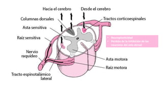 • Neuroplasticidad
• Perdida de la inhibición de las
neuronas del asta dorsal
 