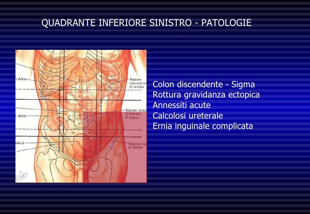 Dolore Addome Acuto