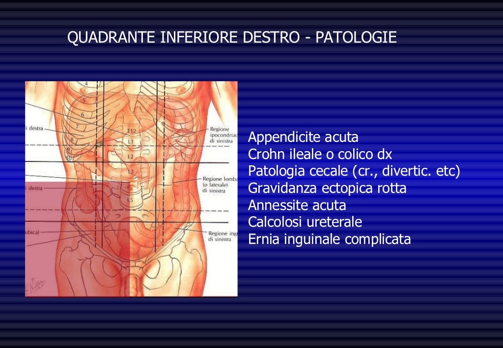 Dolore Addome Acuto