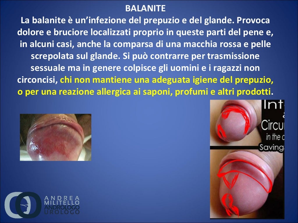 Dolore Alla Base Del Pene Dolore Alla Base Del Pene